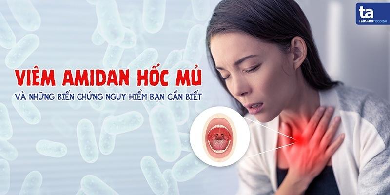 Viêm amidan hốc mủ kiêng ăn gì và nên ăn gì tốt cho người bệnh?