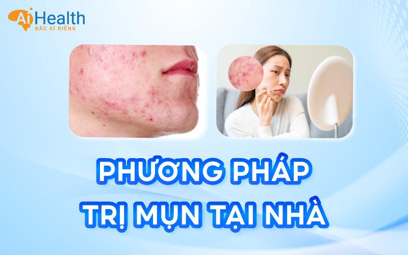 Top 9 cách trị mụn tại nhà đơn giản, ít tốn kém mà hiệu quả