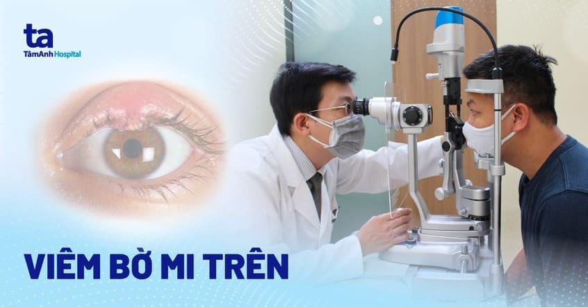 Viêm bờ mi trên mắt: Nguyên nhân, triệu chứng và phòng ngừa