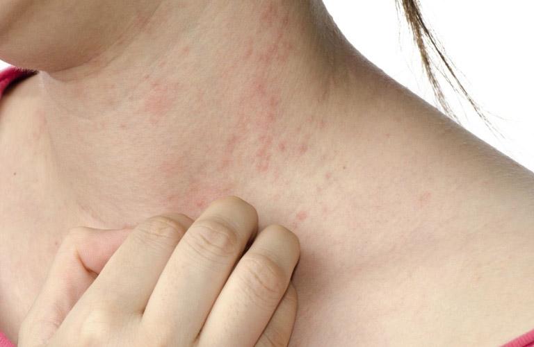 SỞ Y TẾ THÁI NGUYÊN