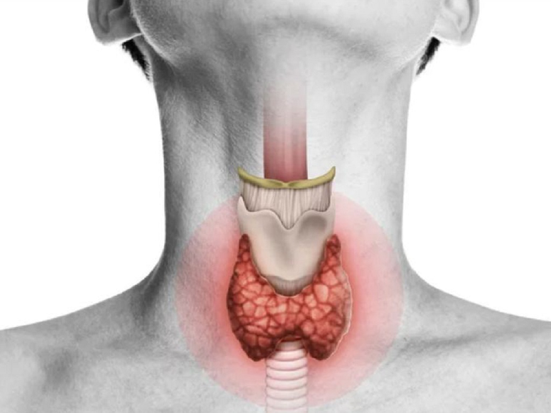 Đánh giá hạch tuyến giáp và dấu hiệu nhận biết ung thư tuyến giáp