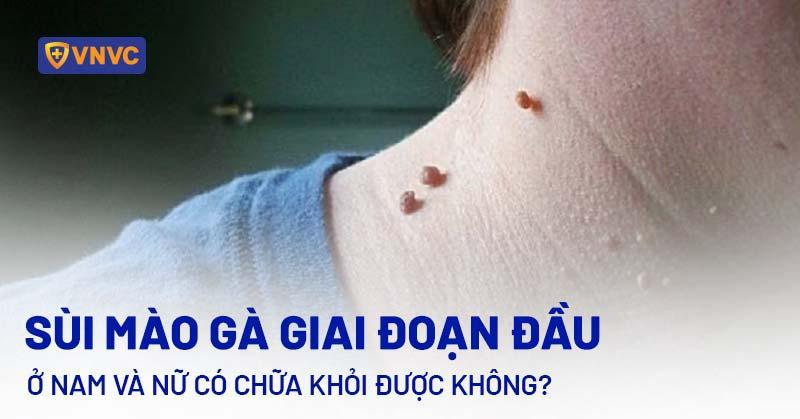 sùi mào gà giai đoạn đầu