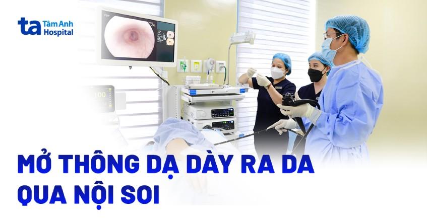 Phẫu thuật mở thông dạ dày ra da qua nội soi (PEG) như thế nào?