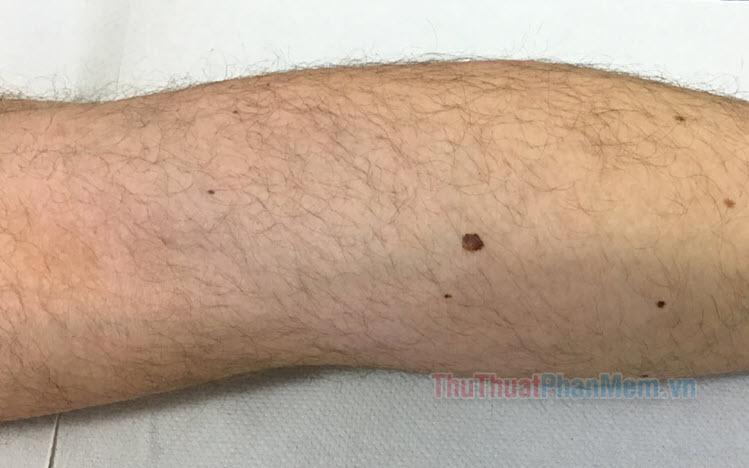 Ý nghĩa nốt ruồi bàn chân của nam và nữ trong phong thủy