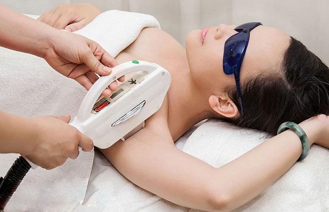 Tác dụng không mong muốn do triệt lông bằng laser