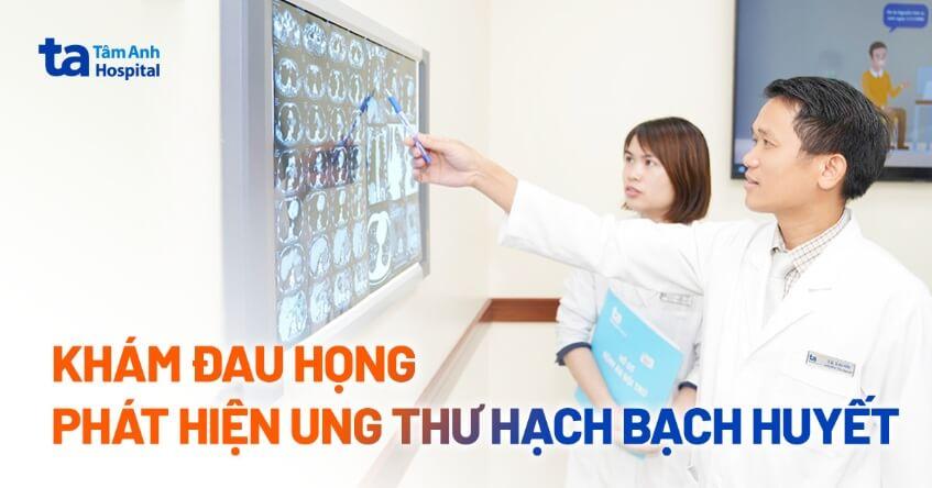 khám đau họng phát hiện ung thư hạch