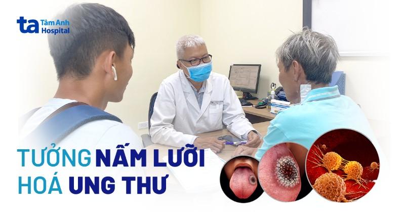 Tưởng nấm lưỡi, hóa ung thư