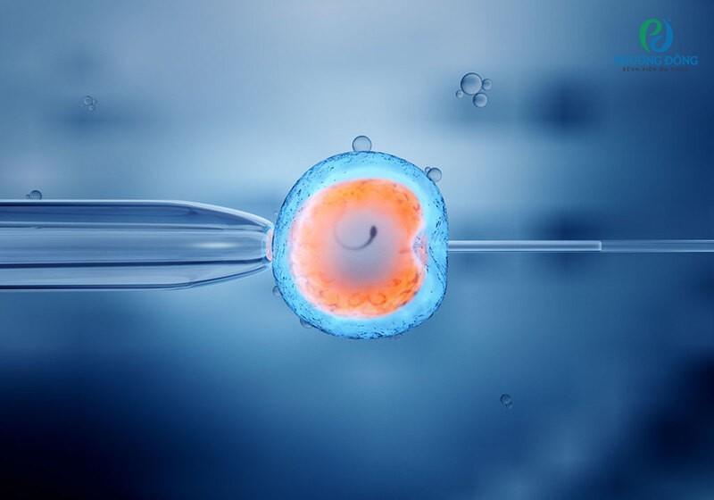 Thụ tinh trong ống nghiệm IVF