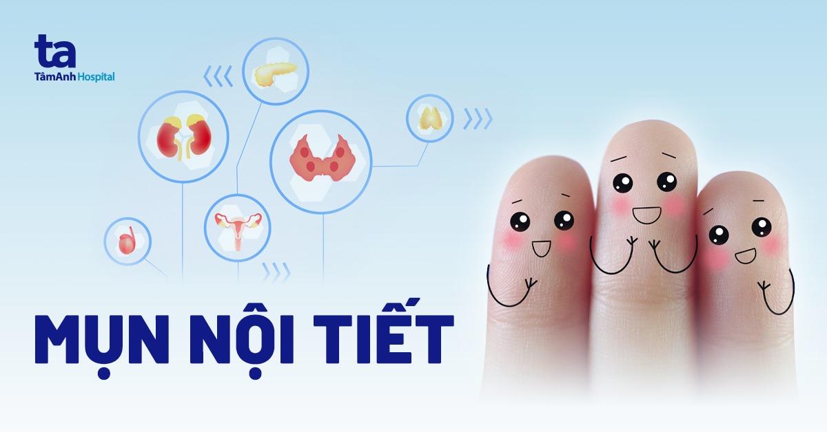 Mụn nội tiết là gì?