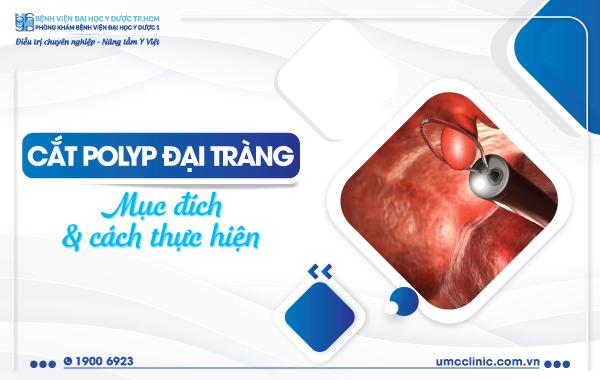 Cắt polyp đại tràng: Mục đích và cách thực hiện