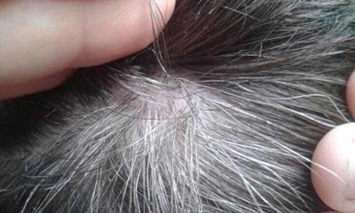 Những thói quen hàng ngày khiến tóc bạc nhiều hơn