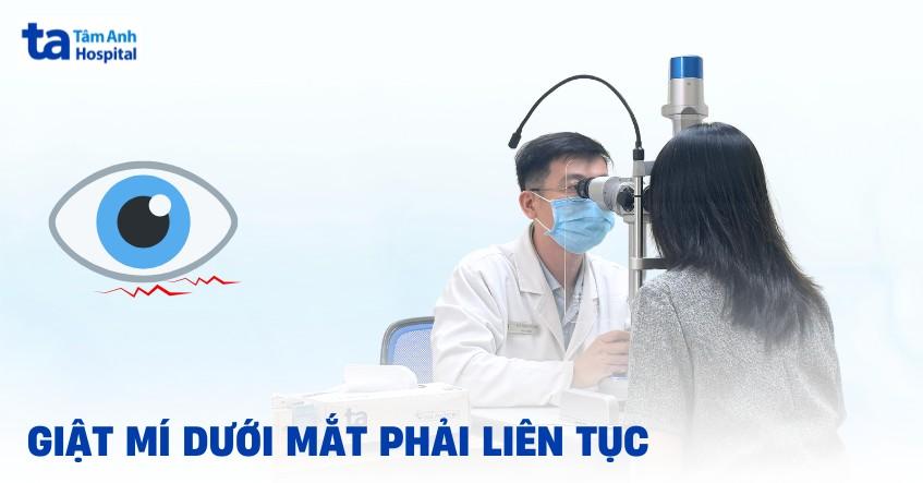 giật mí dưới mắt phải