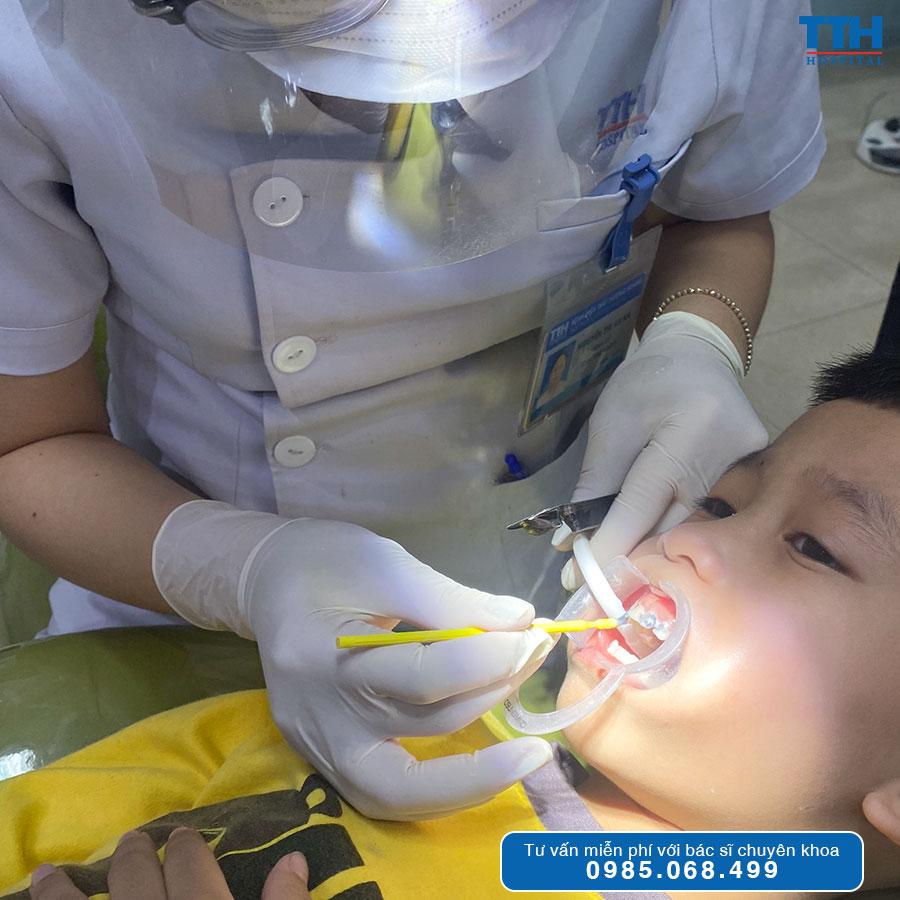 Dự phòng sâu răng bằng Vecni Flour liệu có an toàn cho trẻ?