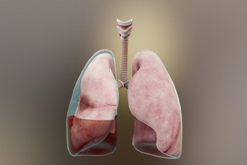 tran-dich-da-mang-o-benh-nhan-ung-thu-1