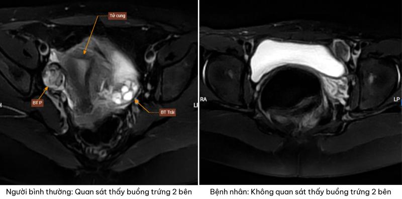 Kết quả xét nghiệm nhiễm sắc thể của bệnh nhân
