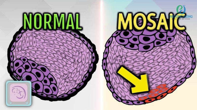 Phôi khảm là phôi hỗn hợp gồm tế bào nhiễm sắc thể bình thường và bất thường