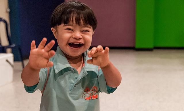 Triệu chứng thiểu năng trí tuệ