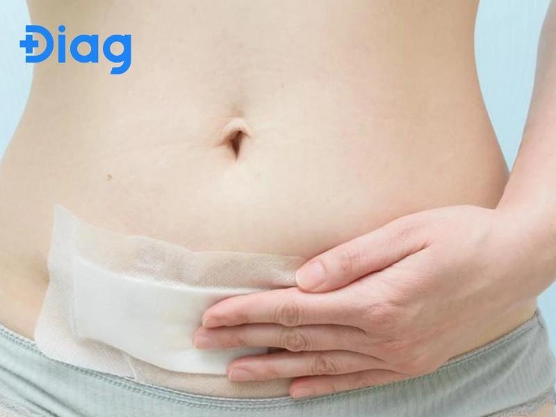 Siêu âm kiểm tra vết mổ sau sinh để theo dõi hậu sản và phát hiện bất thường tiềm ẩn