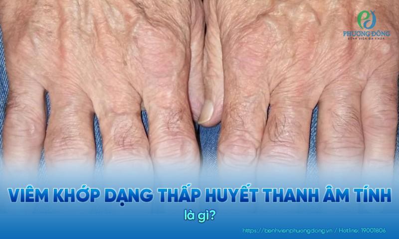 Viêm khớp dạng thấp huyết thanh âm tính không có yếu tố dạng thấp hay kháng thể CCP