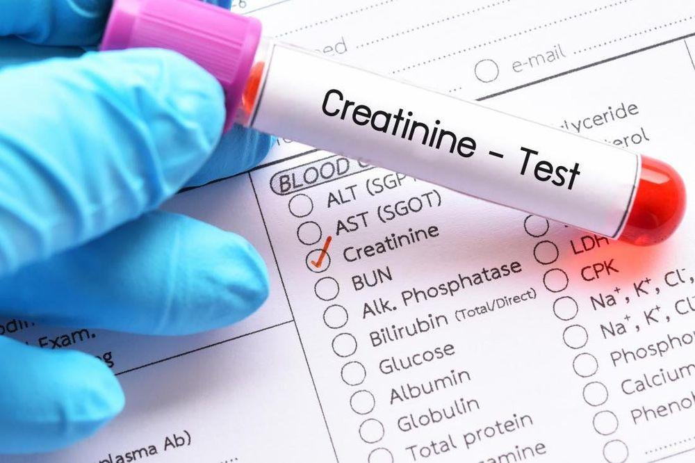 Chỉ số creatinin máu tăng trong hội chứng thận hư.