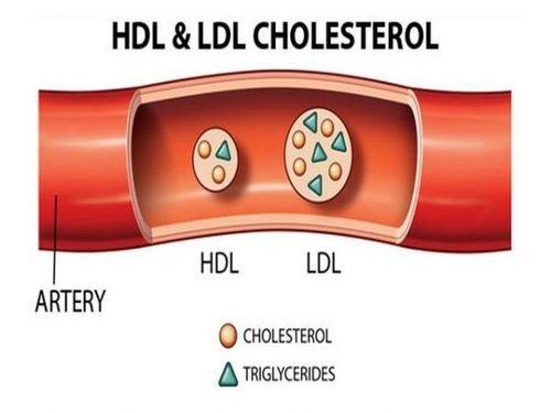 Nồng độ cholesterol toàn phần HDL và LDL