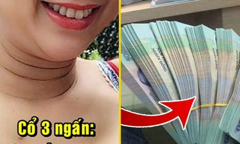 cổ cao ba ngấn 1